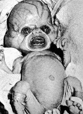 alien baby