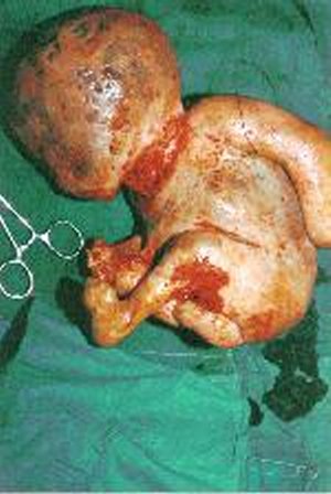 dead baby alien
